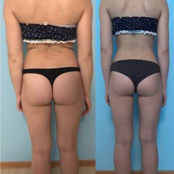 Сергей Беккер , Дніпро Фото - 11