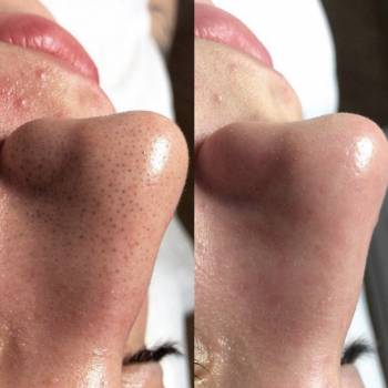 Фото с портфолио Мария Антипенкова 