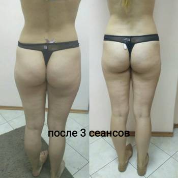 Pink Honey, Дніпро Фото - 30