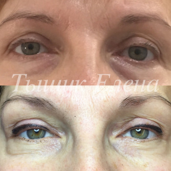 Фото с портфолио Елена Тыщук 