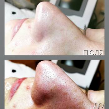 Фото с портфолио Кожум'яка