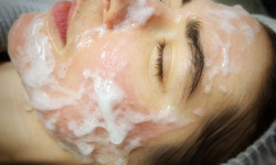 Неінвазивна карбоксітерапія Косметолог Наталия Львов