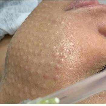 Наталья Скубий , Харків Фото - 6