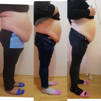 Ліполітики
                    Косметолог-ін'єкціоніст Елена Львів