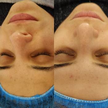 Олена Євдокименко, Миколаїв Фото - 3