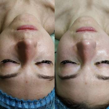 Олена Євдокименко, Миколаїв Фото - 5