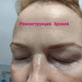 Реконструкция бровей
                    Косметолог Ирина Орел Харьков
