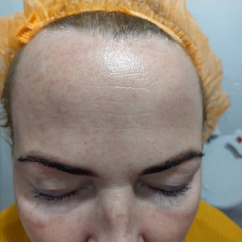 Реконструкция бровей
                    Косметолог Ирина Орел Харьков