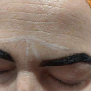 Реконструкция бровей
                    Косметолог Ирина Орел Харьков