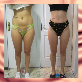 Вакуумно-роликовый массаж, аппаратный
                    Студія татуажу Viva Forever Кривий Ріг