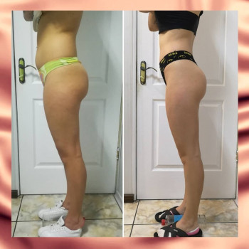 Вакуумно-роликовый массаж, аппаратный
                    Студія татуажу Viva Forever Кривий Ріг