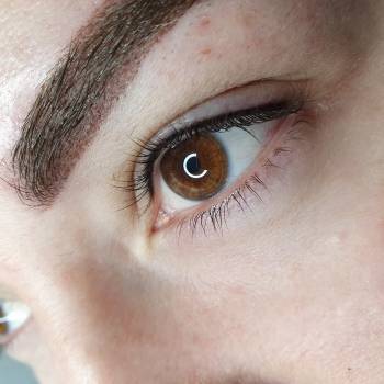 Межресничка