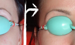 Видалення тату неодимовим лазером, без шрамів Тату салон DopingТattoo Львів