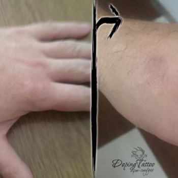 Видалення тату