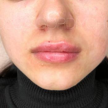 Ольга Гордийчук , Киев Фото - 38