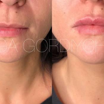 Ольга Гордийчук , Киев Фото - 5