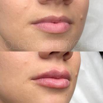 Ольга Гордийчук , Киев Фото - 18