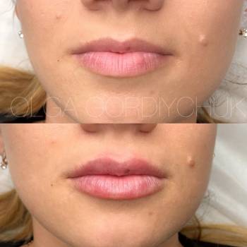 Ольга Гордийчук , Киев Фото - 19