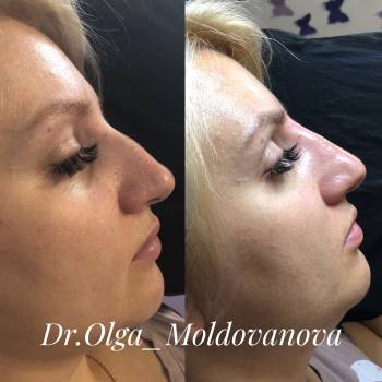 Ольга Молдованова, Одесса Фото - 5