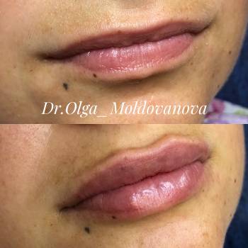 Ольга Молдованова, Одесса Фото - 6