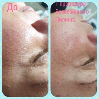 Альбина Михова , Одесса Фото - 10