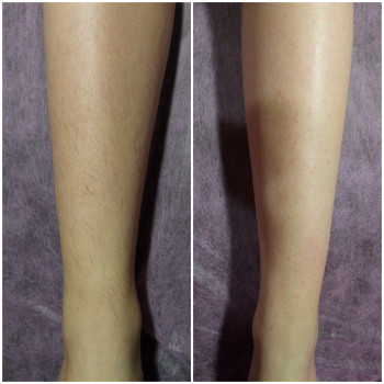 Фото с портфолио Алёна Калиневич 