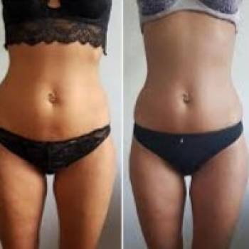 Міла Моісеєнко, Херсон Фото - 14