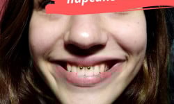 Пірсинг будь-якої складності Тату салон No Mercy Київ