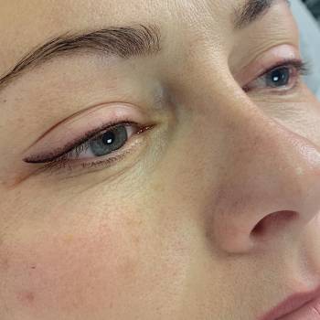 Александра Шпунтова , Вінниця Фото - 34