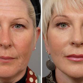 Поли+Клиника, Киев Фото - 5