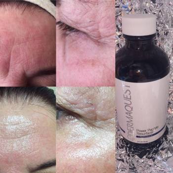 Пептидный пилинг 