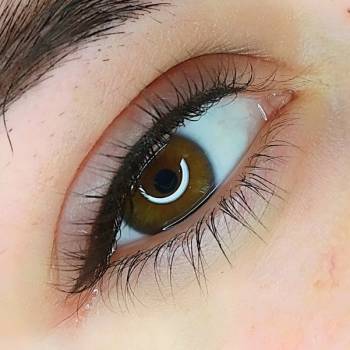 Межресничное пространство сразу после процедуры