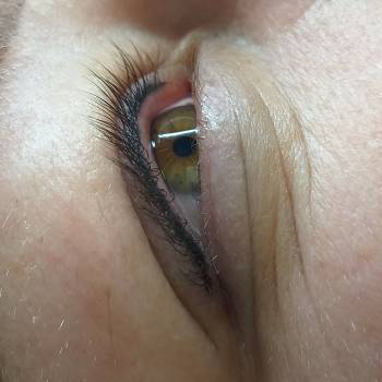 Заповнення міжвійного простору! "Міжвійка" 