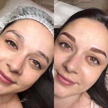 Эскиз / после процедуры