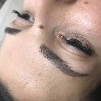 Заживший результат