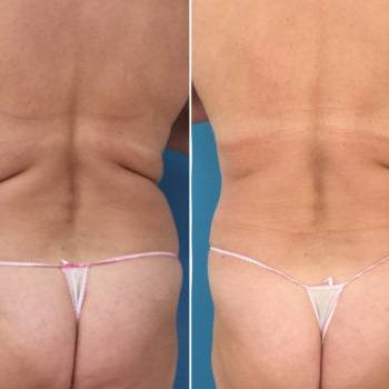 Карина Грицаева, Днепр Фото - 6