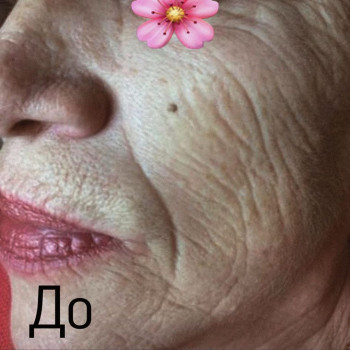 Биоармирование До.