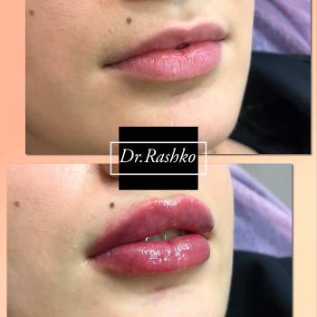 Артур Рашко, Луцьк Фото - 1