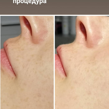 Уход на ТМ PANDHY'S 1 процедура