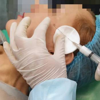 работа канюлей