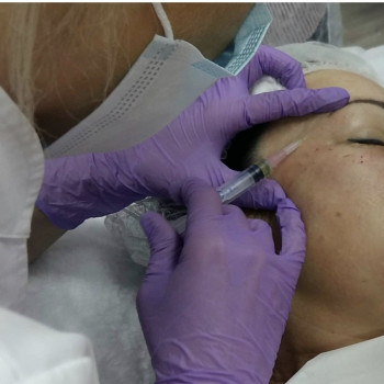 Биоревитализация (биорепарация)
                    Косметолог Юлия Винославская Київ