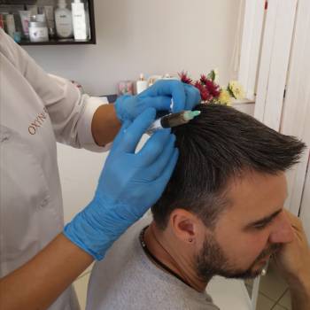 Лечение выпадения, поседения волос