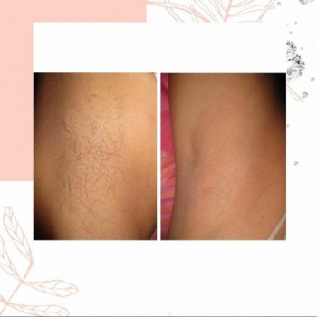 Фото с портфолио Jolie Hair