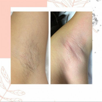 Фото с портфолио Jolie Hair