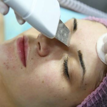 Ультразвуковая чистка лица
                    Лікар-косметолог Любовь Запоріжжя