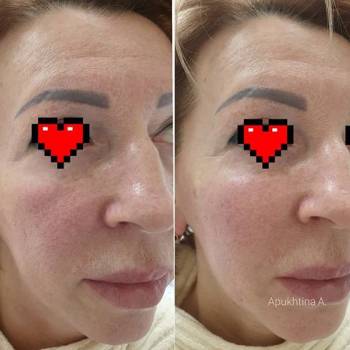 Анна Апухтина , Харьков Фото - 7