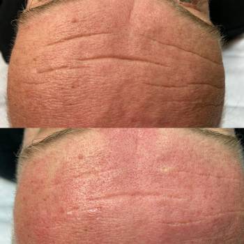 Альбина Михова , Одесса Фото - 45