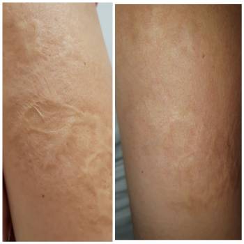 Альбина Михова , Одесса Фото - 47