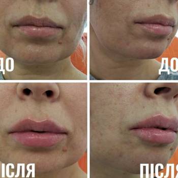 Фото с портфолио Beauty Service