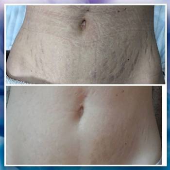 Beautyshapes, Днепр Фото - 5